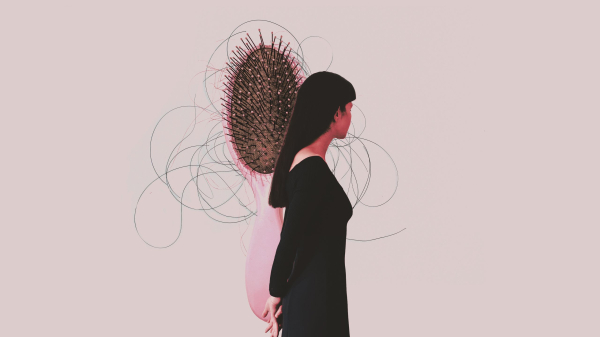 A New Form of Alopecia Is Affecting Menopausal Women